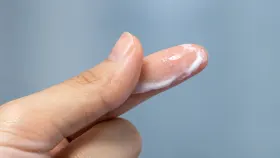 Corrimento transparente sem cheiro: é normal?